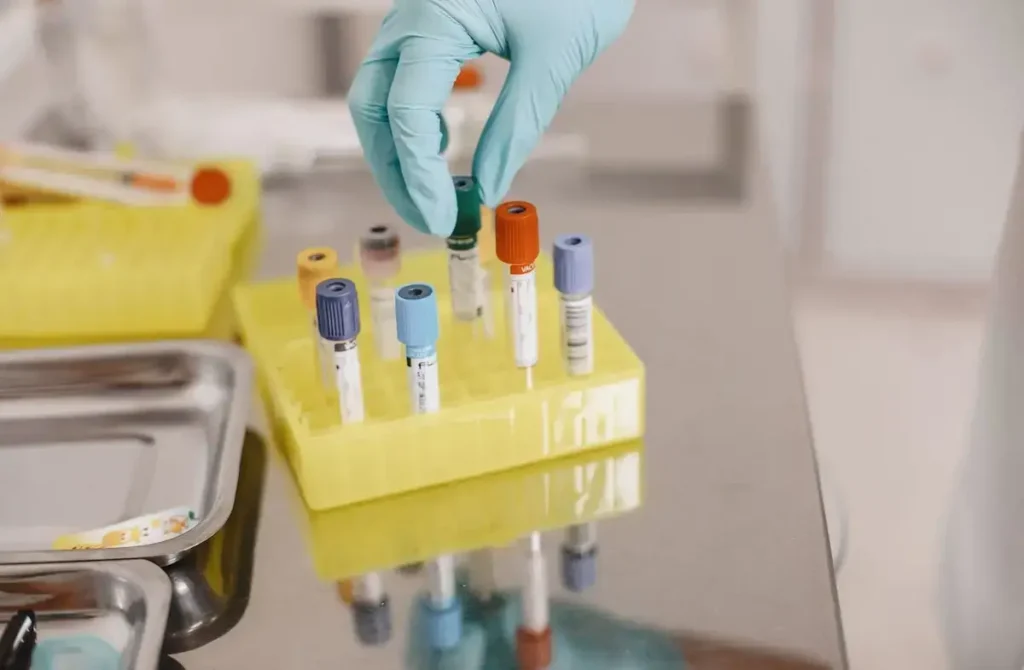 Homem de 40 anos a fazer análises de sangue de rotina